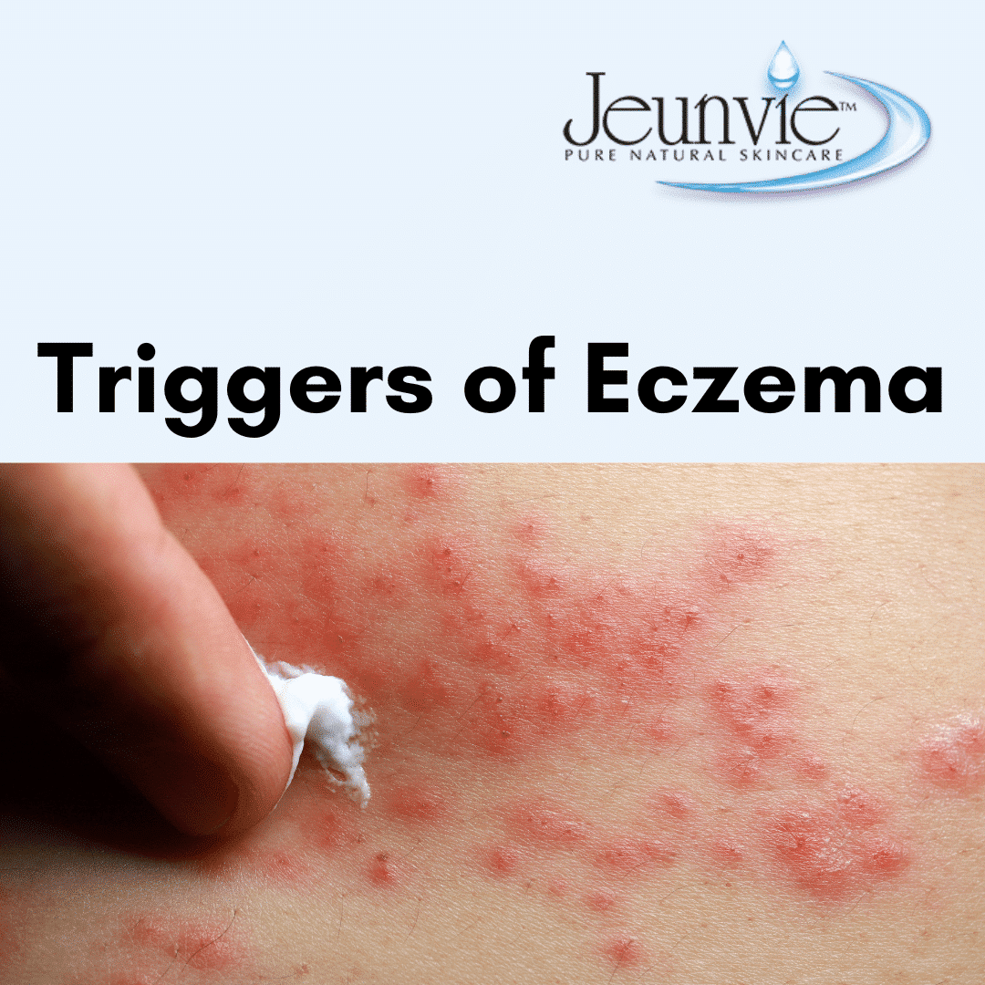 eczema